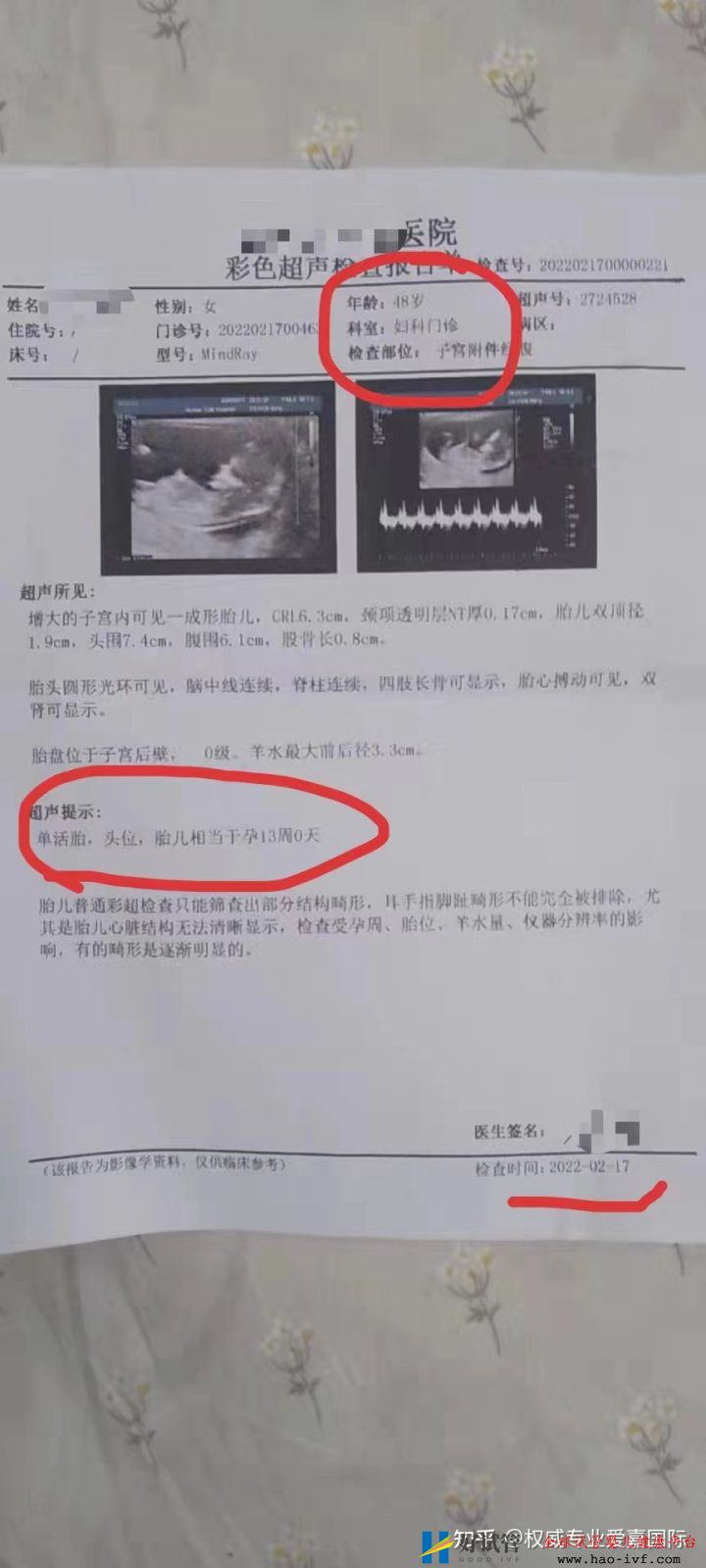 48岁做试管婴儿第三代成功率多少(图1)