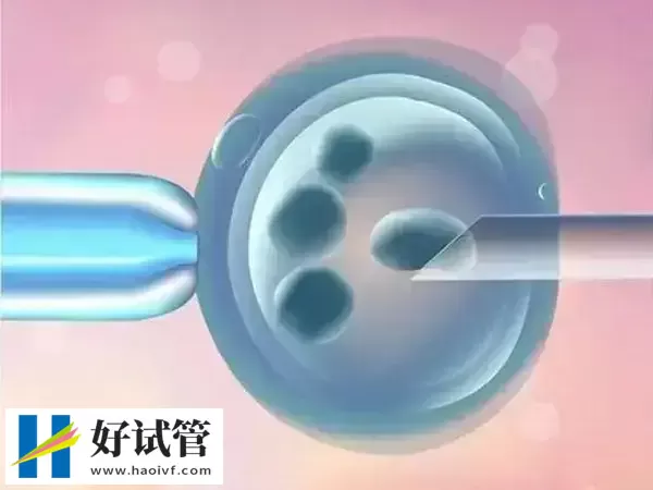 做试管前要看卵巢功能差是否良好