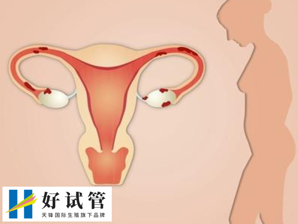 供卵自怀对子宫内膜厚度有要求