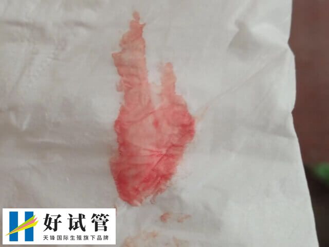 试管移植出血可能是着床出血