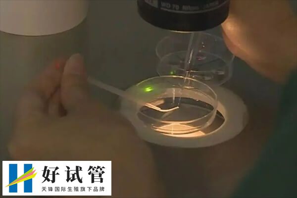 取卵会对卵巢造成刺激和损伤