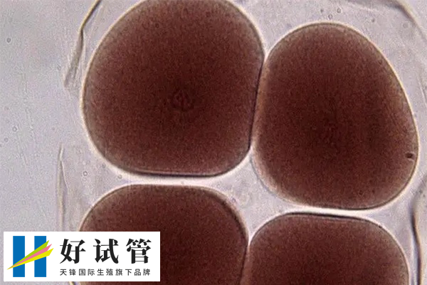 基础卵泡质量比数量更能影响试管成功率