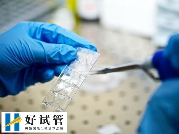 试管婴儿取卵过程并不复杂