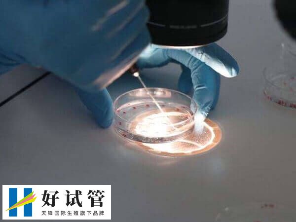 养囊之后是否成功都是要收取一定费用的