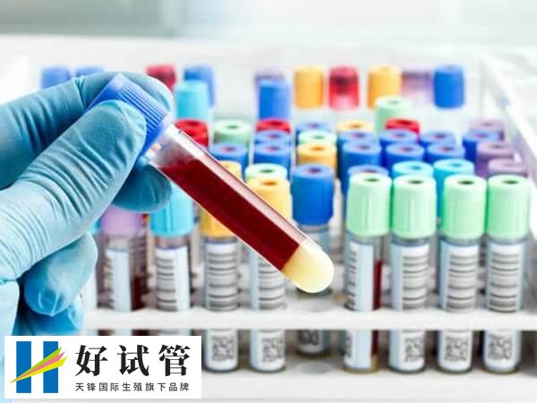 医院挂妇科号检查