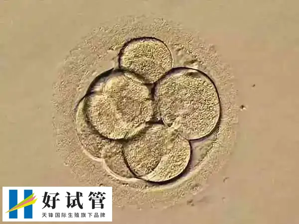 ppos方案是高孕激素促排卵方案